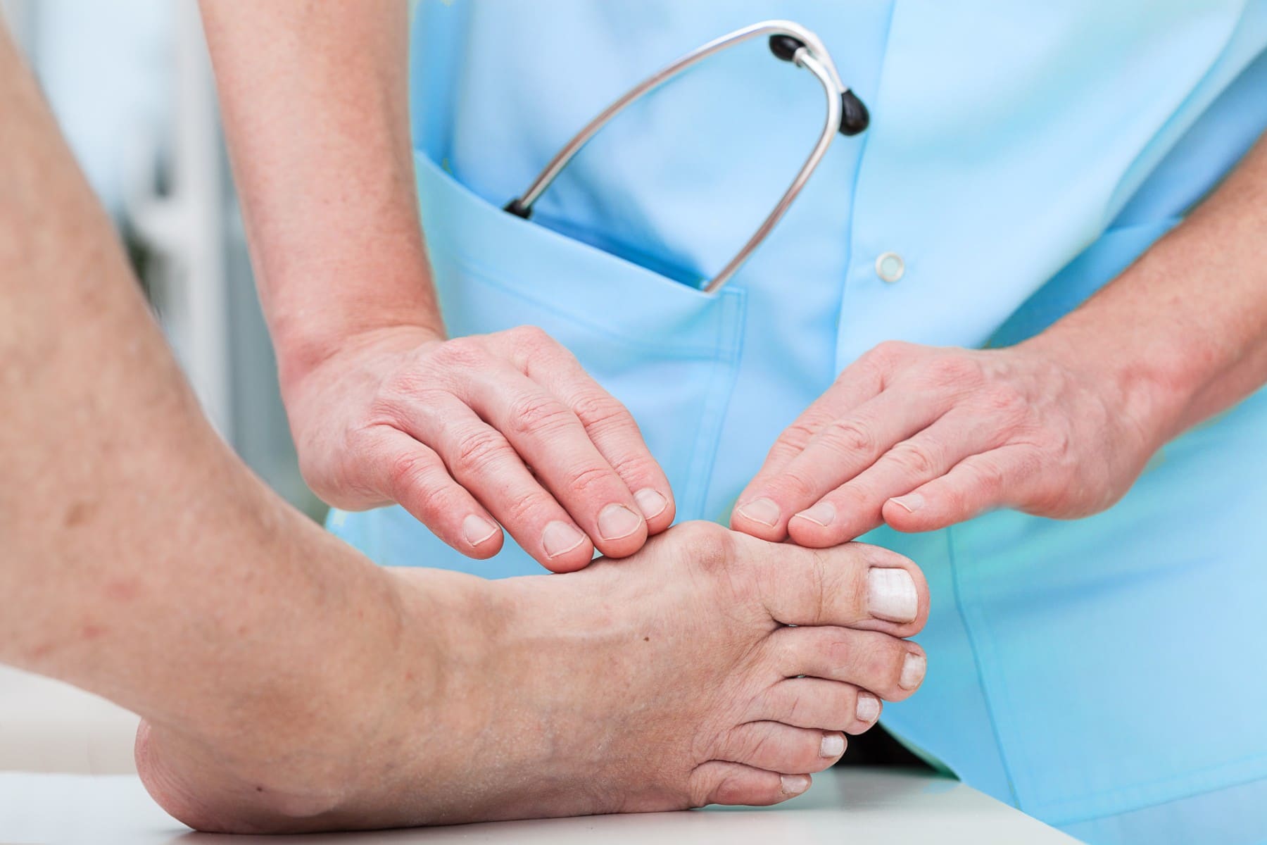 doctor inspecting a bunion