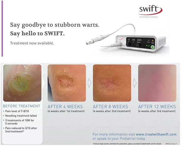 swift before and after image